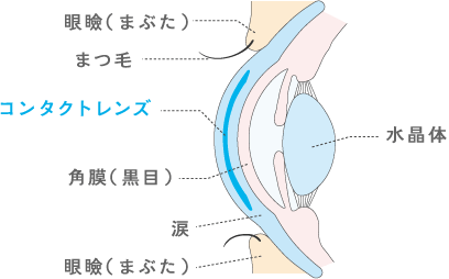 コンタクトレンズ 着用図