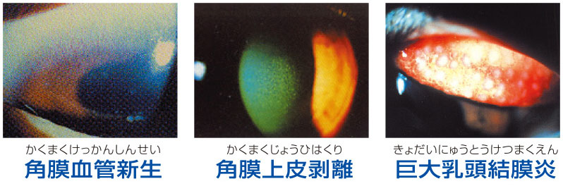 眼疾患 症例